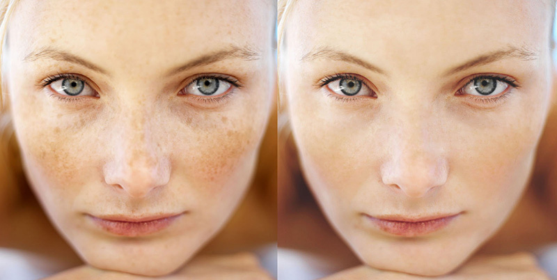 Young Woman Lying on Massage Table --- Image by © Royalty-Free/Corbis