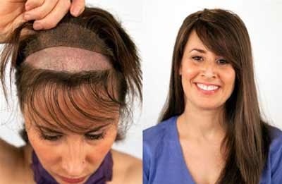 جایگزین کردن مو